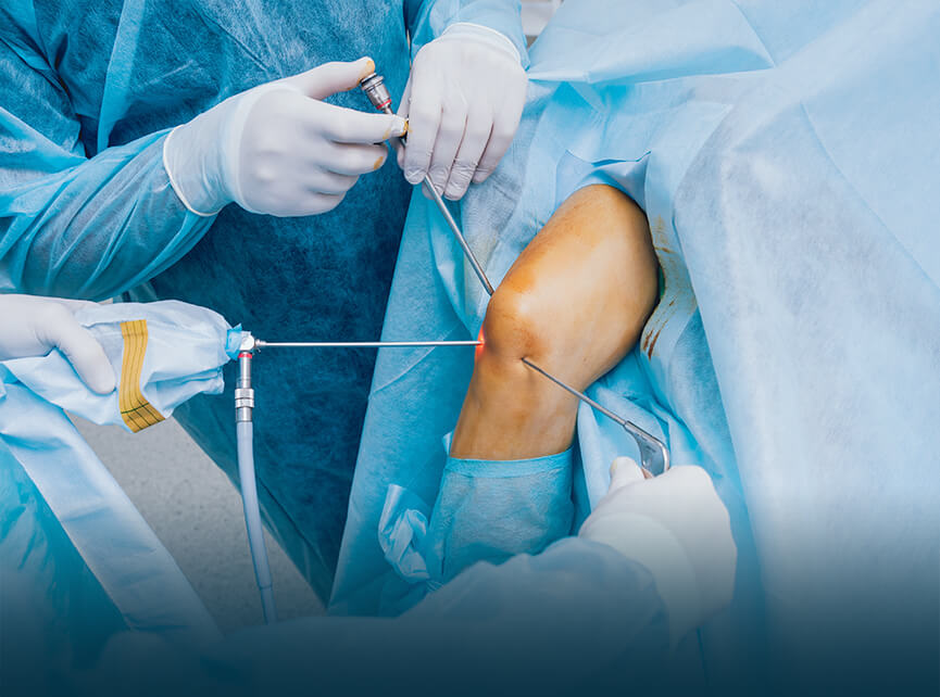 Knee Surgery